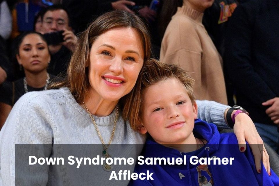 Down Syndrome Samuel Garner Affleck (1)